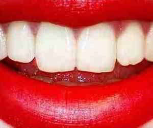  კბილები სიზმარში. რას ნიშნავს სიზმარში კბილების დანახვა ან კბილების დაკარგვა